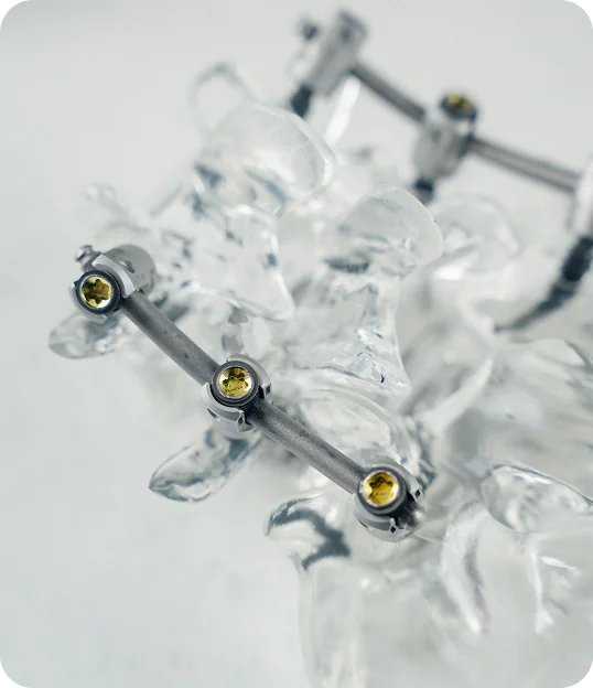 Spine medical device - in Carmel, IN