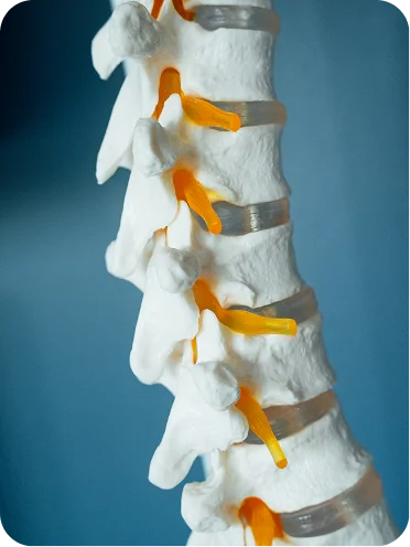 Anatomical model of lumbar spine showing vertebrae, intervertebral discs, and spinal nerves in orange - in Carmel, IN
