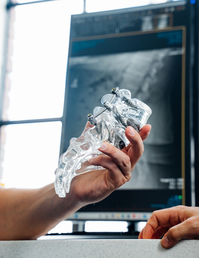 Hand holding spinal medical device - Cervical deformity in Carmel, IN