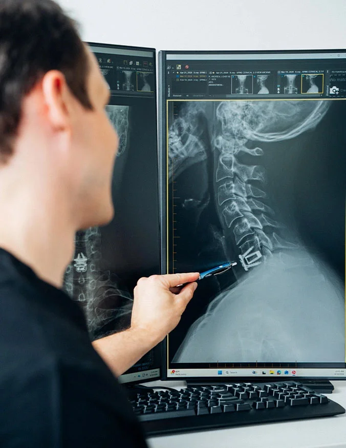Cervical-Myelopathy-intro-1